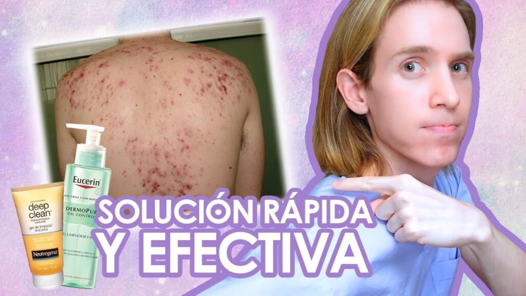 Cómo quitar granitos y manchas de la espalda