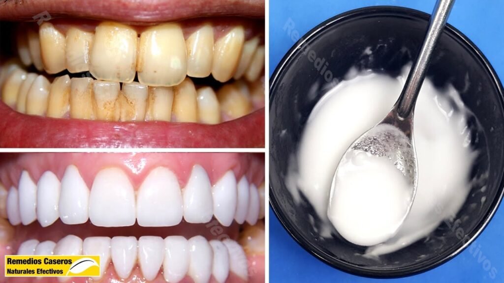 Cómo quitar las manchas amarillas de los dientes remedios caseros