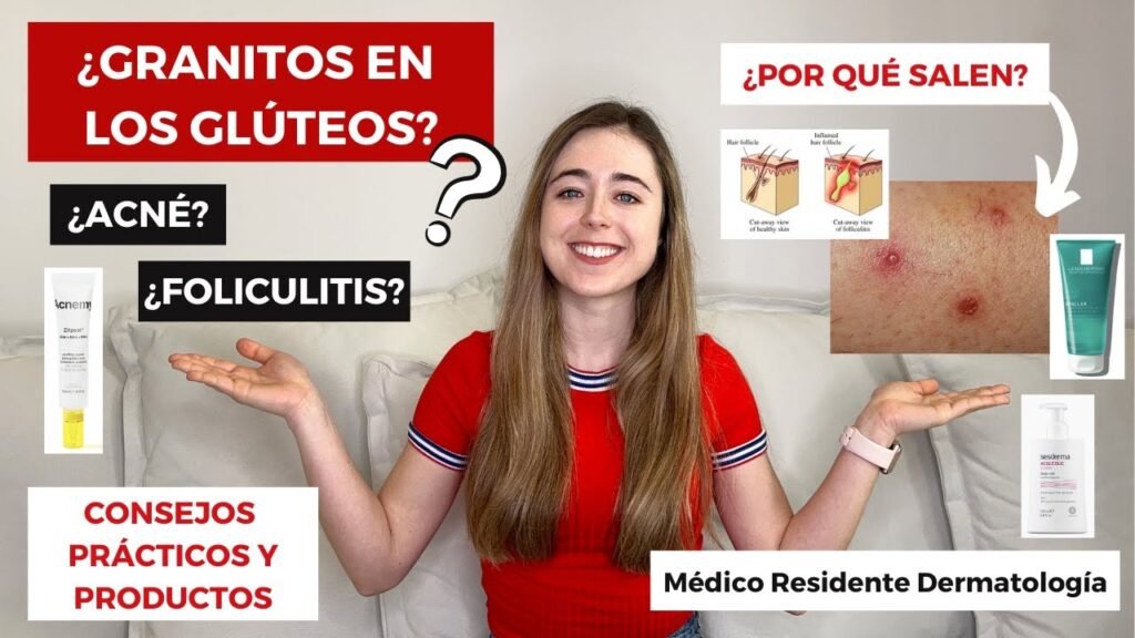Cómo quitar las manchas de granos en los glúteos