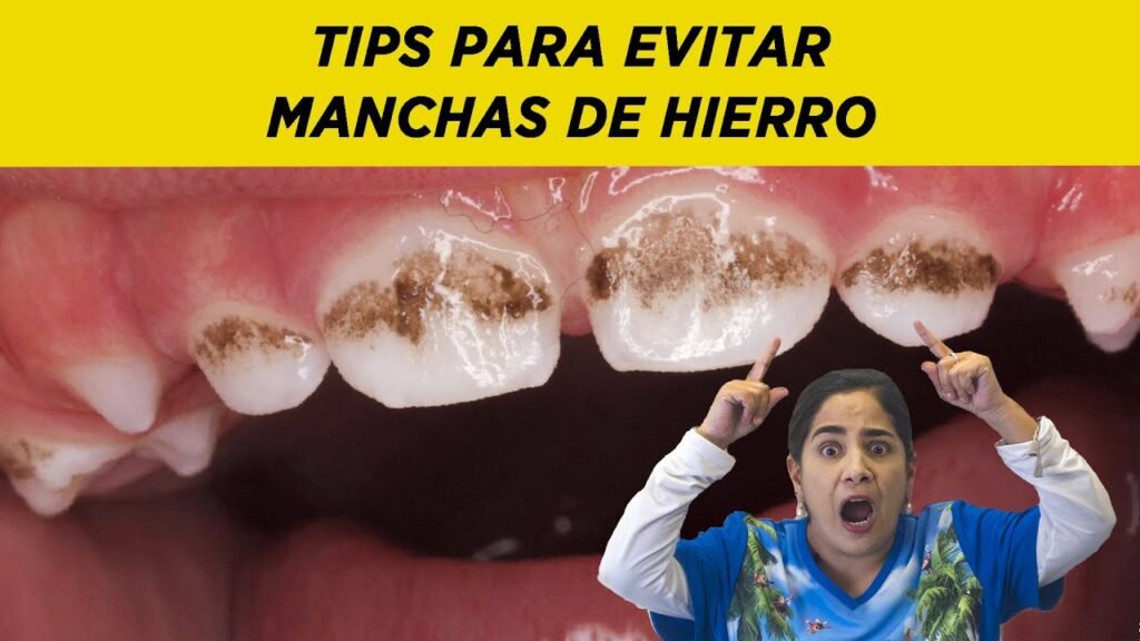 Cómo quitar las manchas de hierro en los dientes