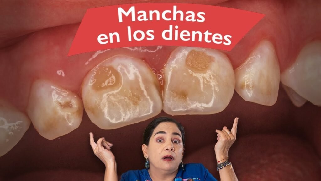 Cómo quitar las manchas de los dientes de un bebe