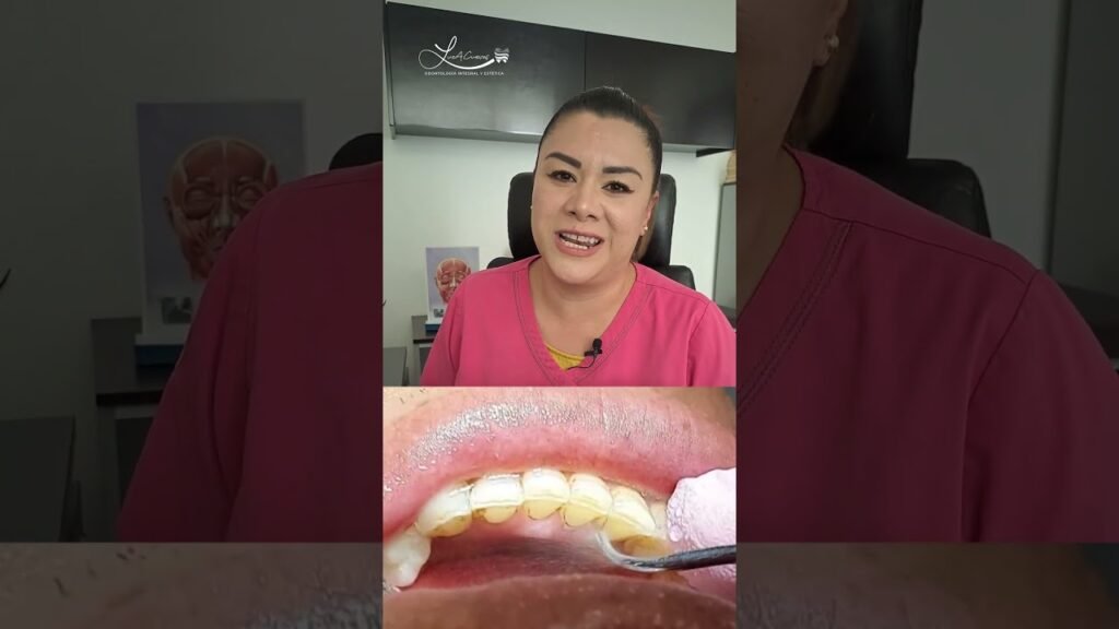 Cómo quitar las manchas de nicotina de los dientes