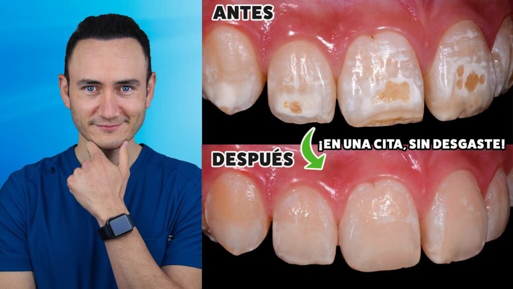 Cómo quitar las manchas naranjas de los dientes