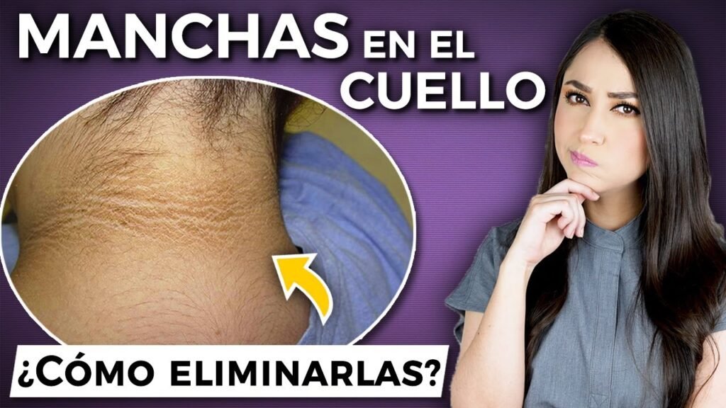 Cómo quitar las manchas negras en el cuello