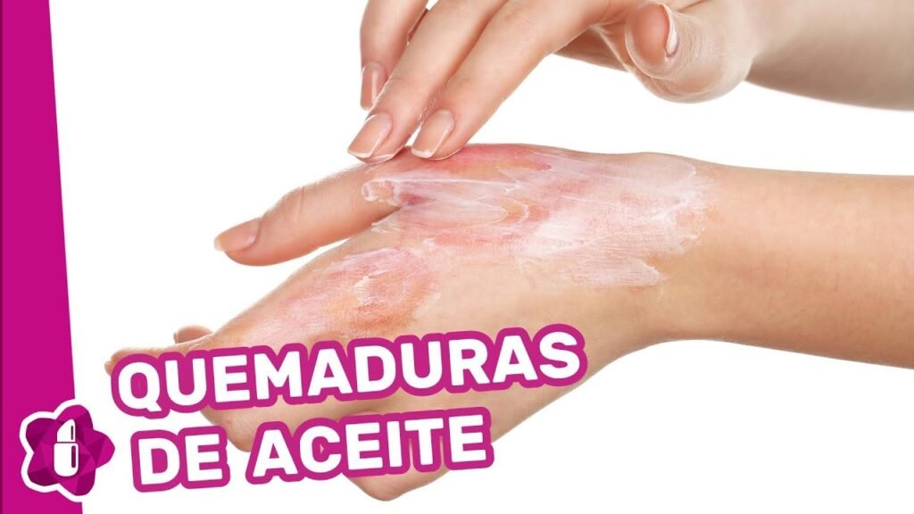 Cómo quitar mancha de quemadura de aceite