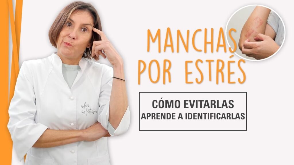 manchas por estres Cómo quitarlas
