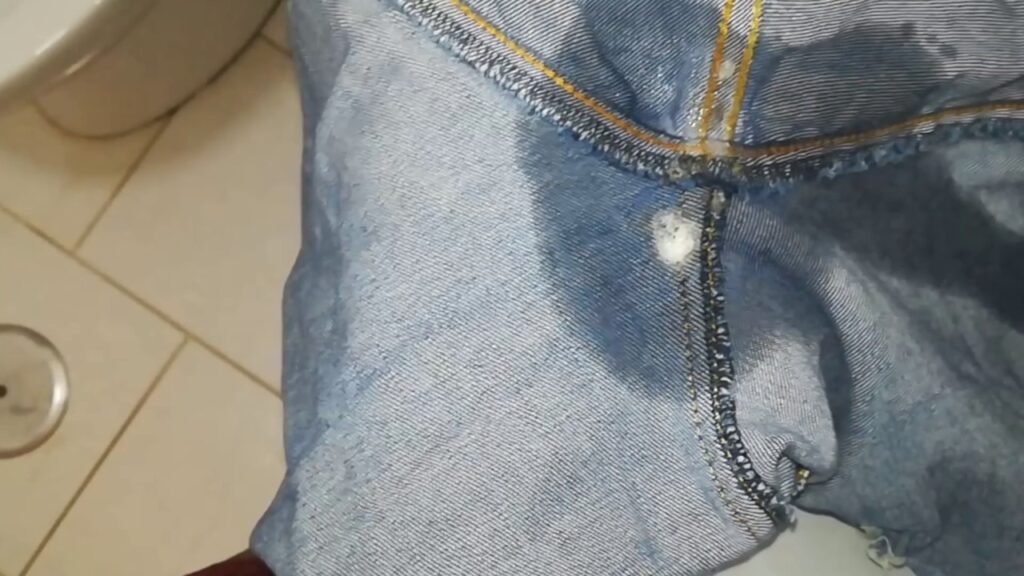 Cómo quitar mancha de sangre en pantalon vaquero