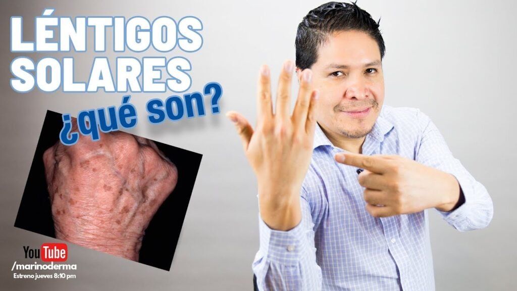 manchas en las manos Cómo quitarlas
